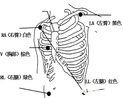 心電監(jiān)護儀1.jpg